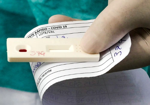 Teste Corona Vírus SUS